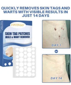 Fivfivgo® Moles & Warts Removing Skin Tag Patch