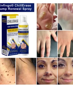 Fivfivgo® ChillErase Bump Renewal Spray