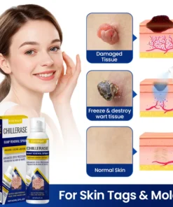 Fivfivgo® ChillErase Bump Renewal Spray