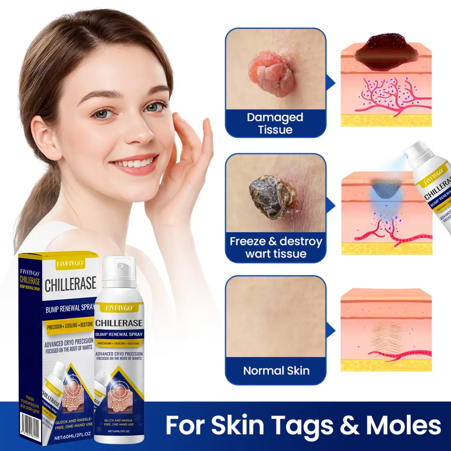 Fivfivgo® ChillErase Bump Renewal Spray