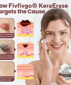 Fivfivgo® KeraErase Dual-Action Renewal Cream