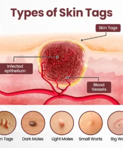 Fivfivgo® KeraErase Dual-Action Renewal Cream