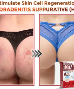 Fivfivgo® MicroNeedle Botanic Skin Tag Removal Patch Made in the USA