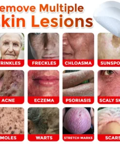 Fivfivgo® MicroNeedle Botanic Skin Tag Removal Patch Made in the USA