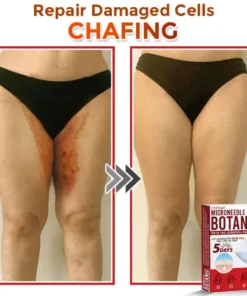 Fivfivgo® MicroNeedle Botanic Skin Tag Removal Patch Made in the USA