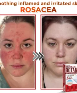 Fivfivgo® MicroNeedle Botanic Skin Tag Removal Patch Made in the USA